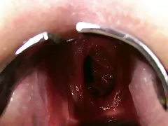 बटन के कफ और कैंसर में स्नातक की उपाधि प्राप्त की चूत सुंदर युवा अश्लील वीडियो